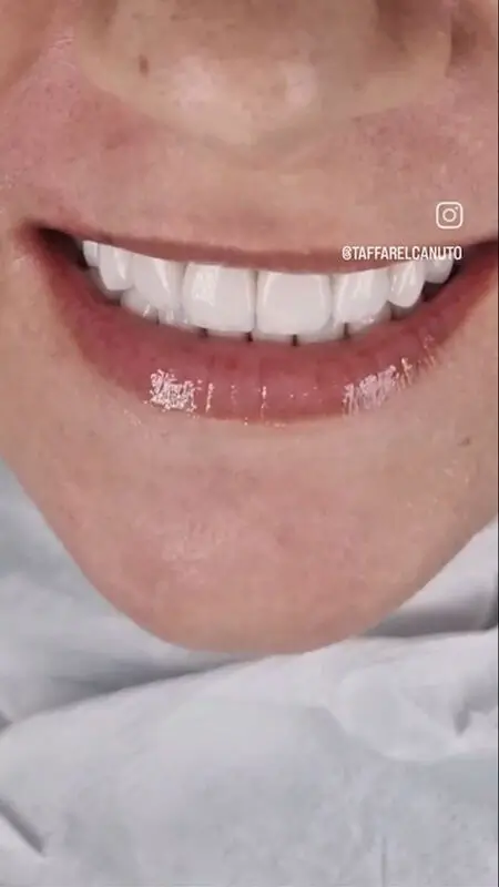 Imagem da transformação do Sorriso do Cliente 1