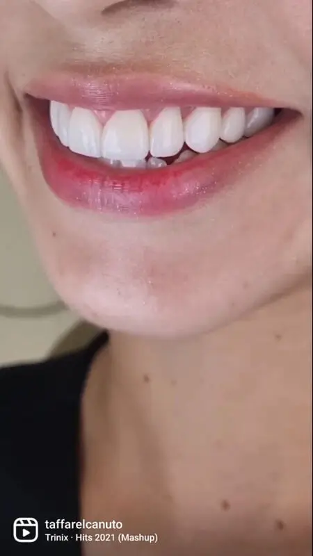 Imagem da transformação do Sorriso do Cliente 2