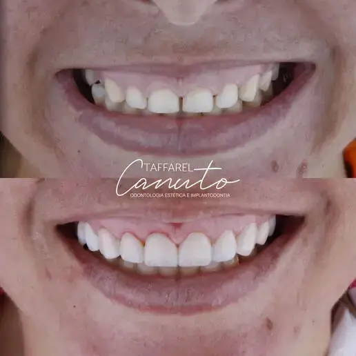 Resultado Antes e Depois do Cliente 4