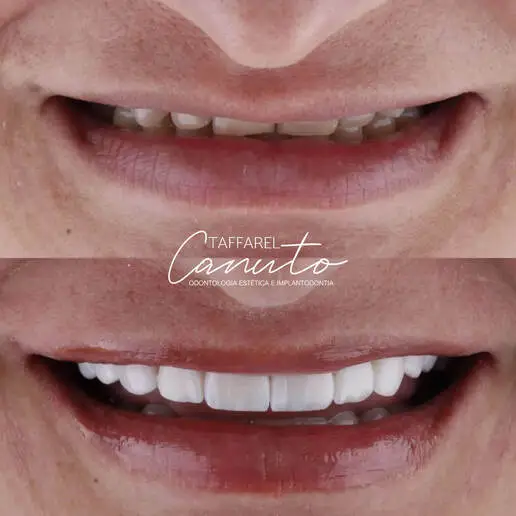 Resultado Antes e Depois do Cliente 5
