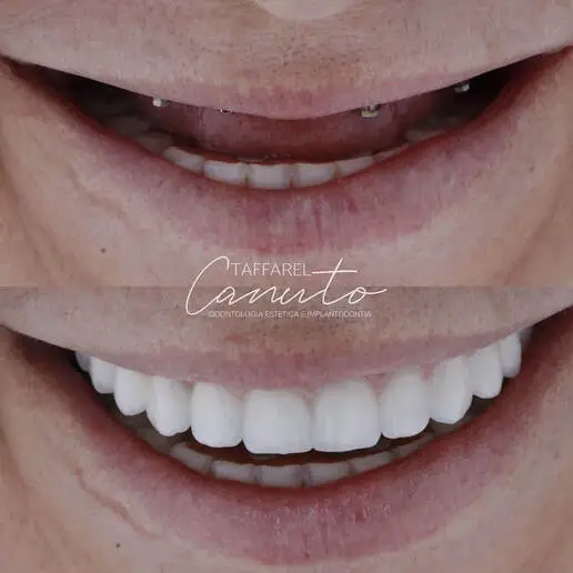 Resultado Antes e Depois do Cliente 6